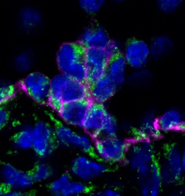 Blood Stem Cell Formation in Embryo