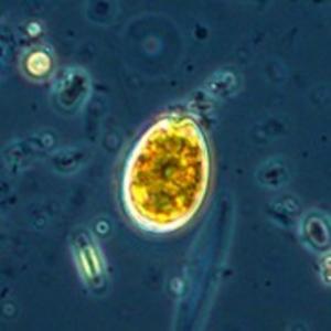 Microscopic View of Prorocentrum lima Dinoflagellate