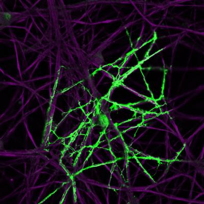 How Myelination Keeps in Tune with Neuronal Activity (1 of 4)