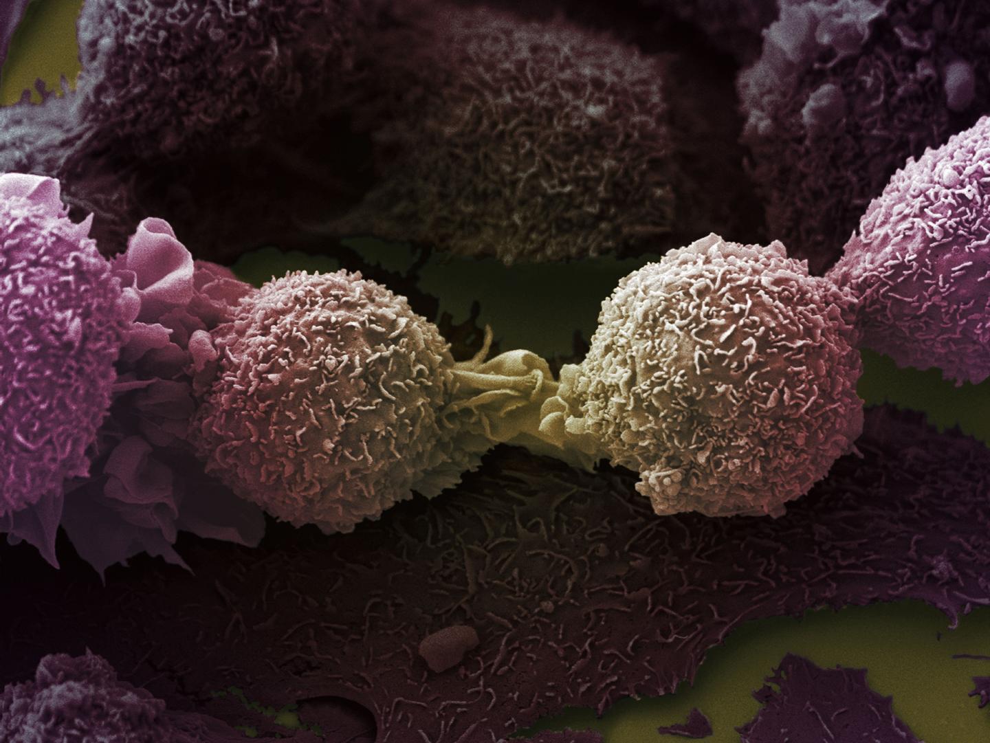Lung Cancer Cells