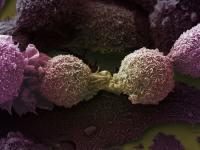 Lung Cancer Cells