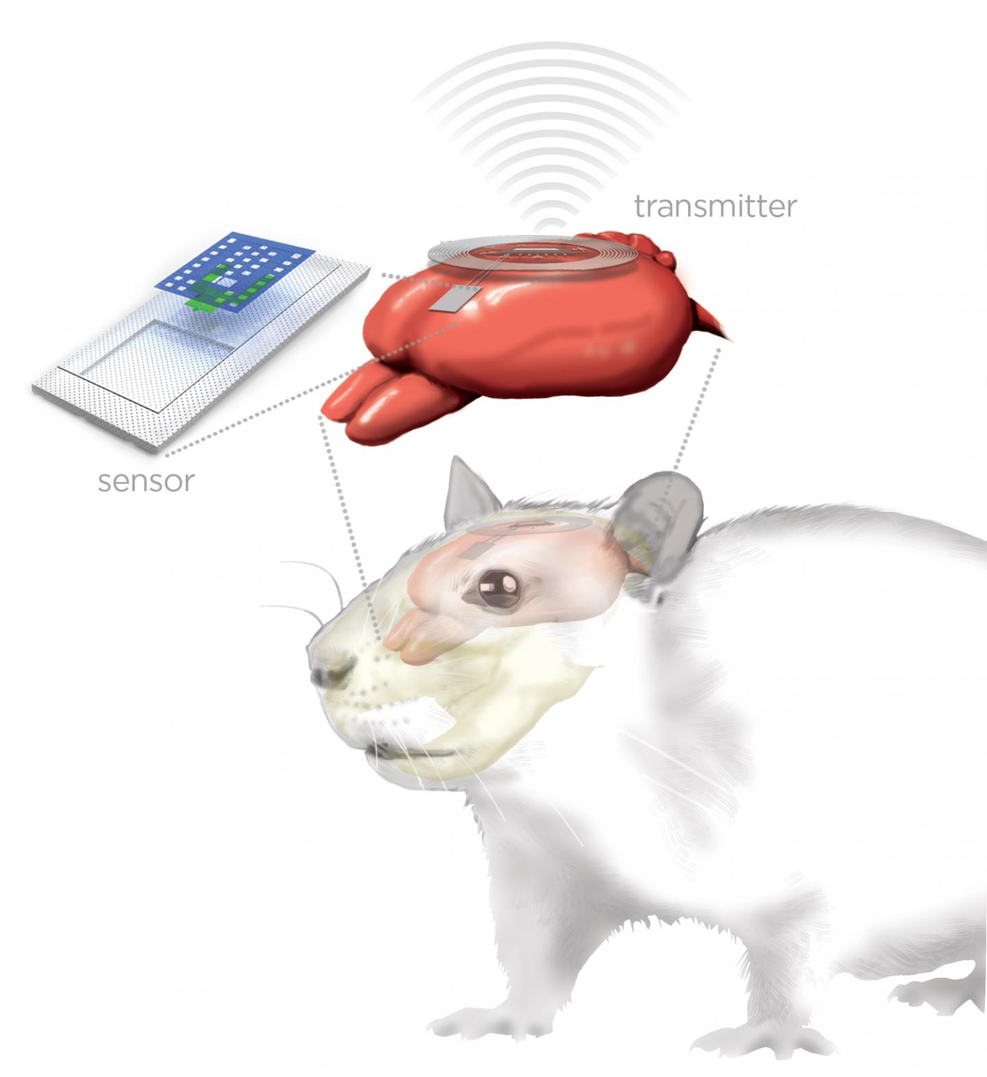 Bioresobable Brain Sensor