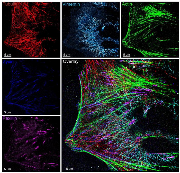Super-resolution image of cytoskeleton and focal adhesion proteins taken using the new versatile and cost-effective microfluidics system. The “overlay” of all the different target molecules reveals exquisite and complex detail up to 100 times sharper