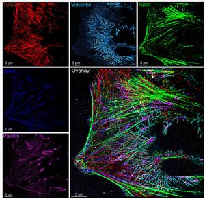 Super-resolution image of cytoskeleton and focal adhesion proteins taken using the new versatile and cost-effective microfluidics system. The “overlay” of all the different target molecules reveals exquisite and complex detail up to 100 times sharper