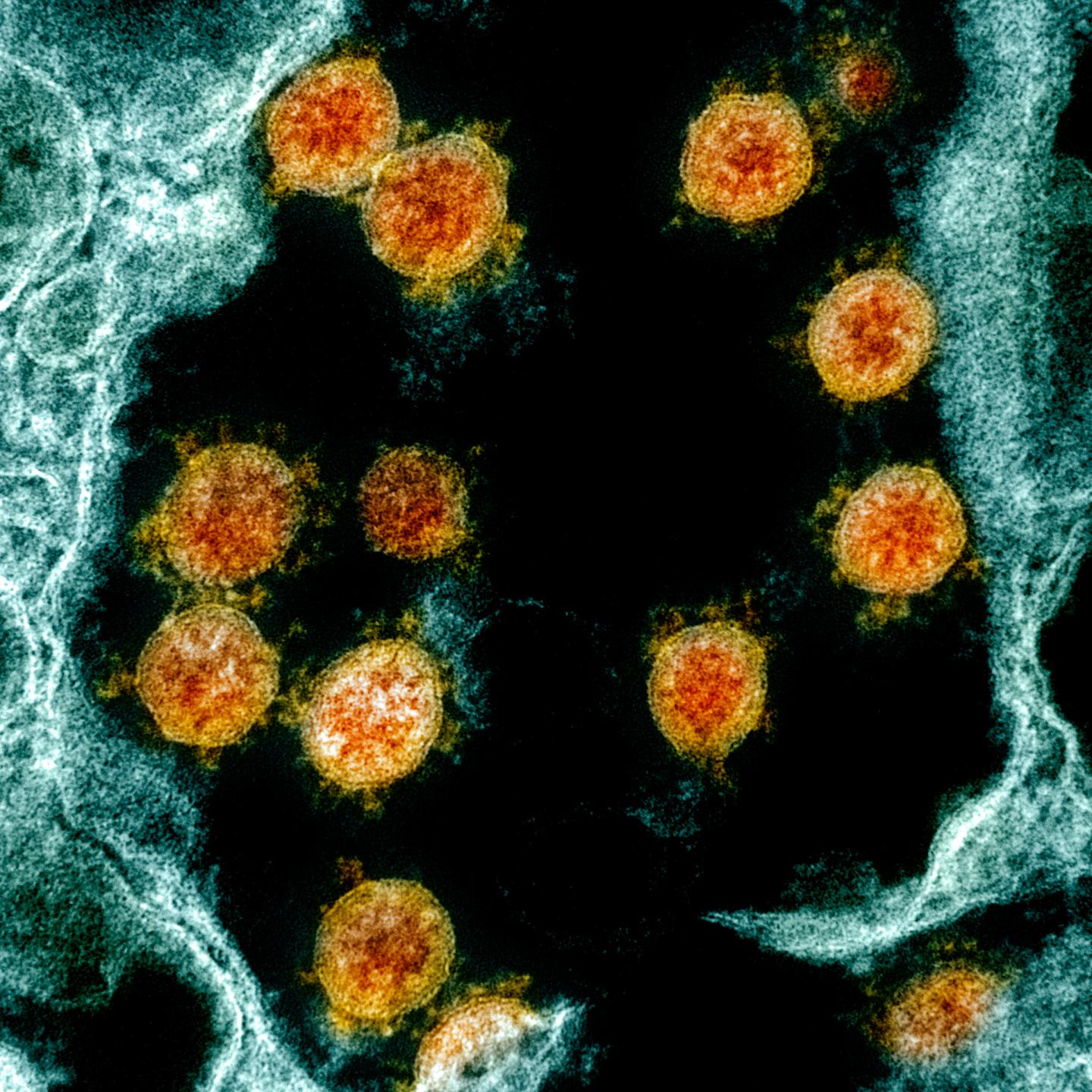 Colorized Transmission Electron Micrograph