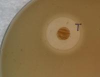 Bacteria in a Dish of MRSA, Showing How It Inhibits the Spread
