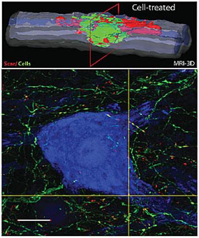 Stem Cell SCI Repair