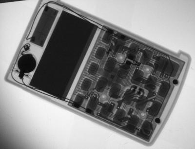 Portable X-Rays