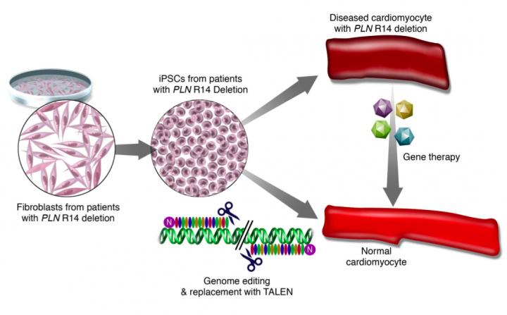 Heart Failure Gene Editing
