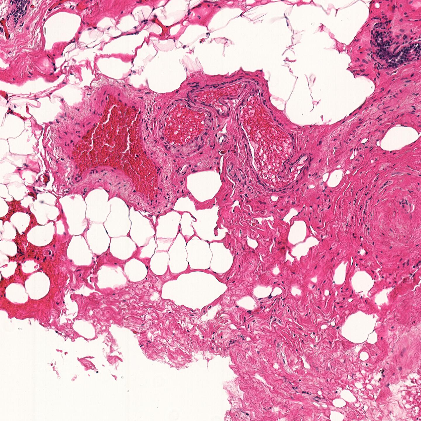 A Tissue Sample Viewed under a Microscope