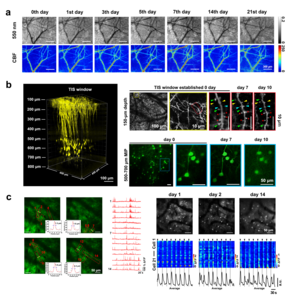 Cortical neurovascular imaging through TIS window.