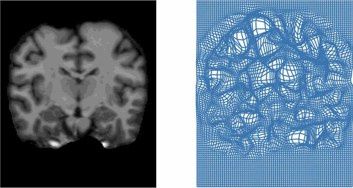 Comparing Brain Scans Using FireANTS