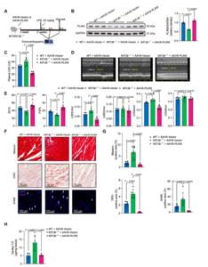 Fig.7. Cardiac-specific restoration of PLIN5 mitigates sepsis-induced cardiac dysfunction in Kif13b-/- mice