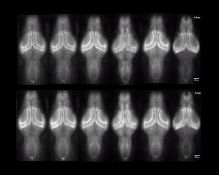 Differential Brain-Wide Response in Larval Zebrafish