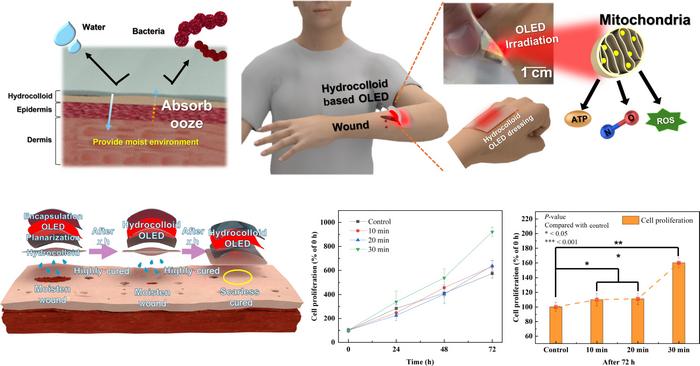 A novel and advanced method for treating wound using Hydrocolloid-based wearable OLED patch.