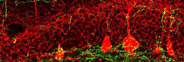 Juan Song Neurogenesis