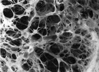 Damaged Lung