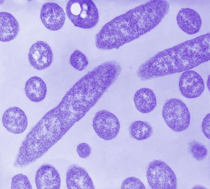 Legionella pneumophila