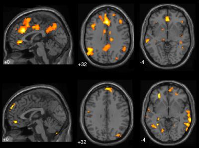 Brain Scans
