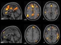 Brain Scans