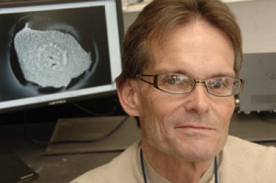 Dr. Edward Keefer, UT Southwestern Medical Center