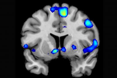 The Spiritual Brain