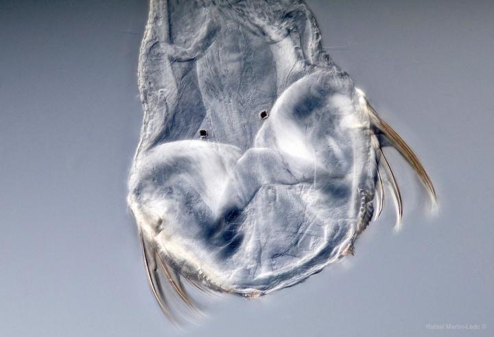 the Head of the Arrow Worm