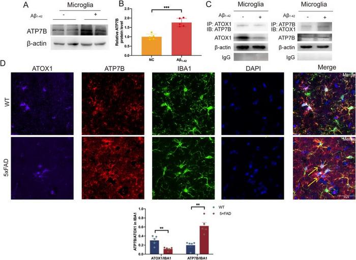 ATOX1 exerts a functional role in AD through interaction with ATP7B.