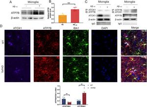 ATOX1 exerts a functional role in AD through interaction with ATP7B.