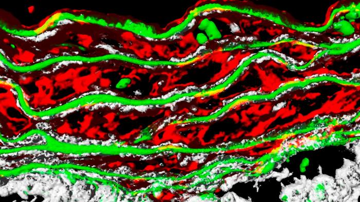 Detail of the aortic wall in an experimental model of Marfan syndrome