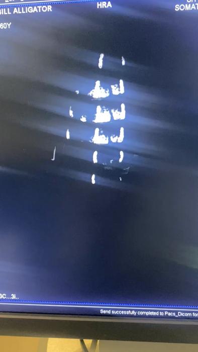 Bill crocodile CT scan