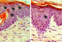 Mouse Skin Samples of the Rare Genetic Skin Disease Amyloidosis