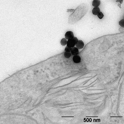 Iron Oxide Nanoparticles