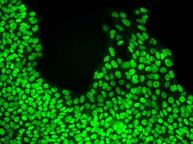 Stem Cells Suitable for Clinical Therapy