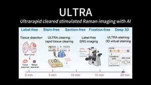 Seeing Tumor Boundaries in 3D Within 30 Minutes: Cell Study Develops a New Intraoperative Imaging Platform for Glioma Infiltration