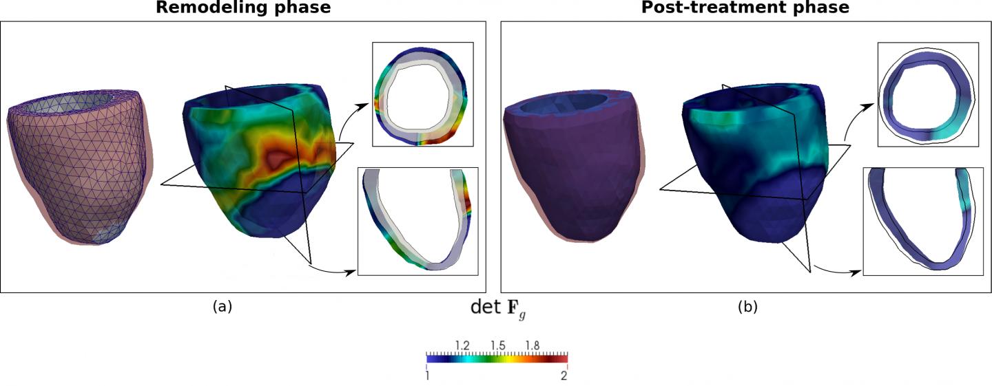 Geometrical Changes of the Left Ventricular