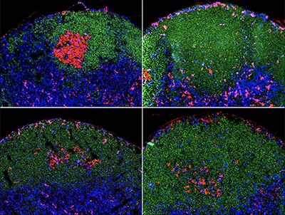 Follicular Helper T Cells