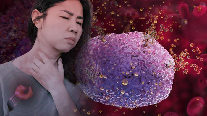 Food-induced anaphylaxis