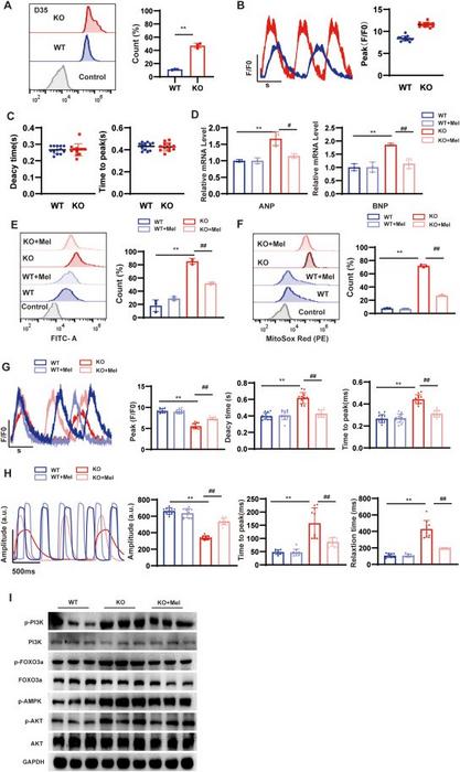 Melatonin alleviates hypertrophic cardiomyopathy.