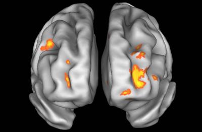 Brain Study