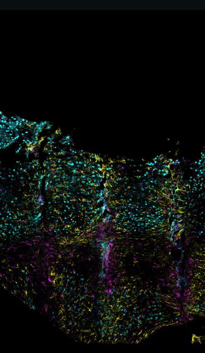 Friend, Not Foe: Lowered Tissue Reactivity to Long-Term Polyimide Implants