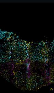 Friend, Not Foe: Lowered Tissue Reactivity to Long-Term Polyimide Implants