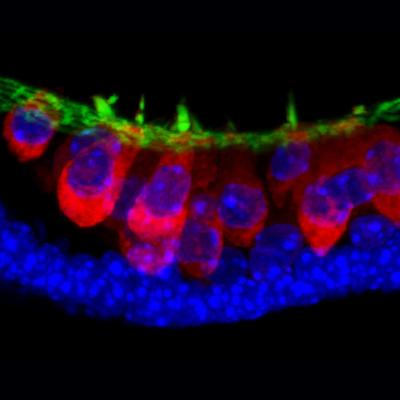 Stem-Cell-Derived Sensory Hair Cells
