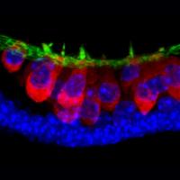 Stem-Cell-Derived Sensory Hair Cells
