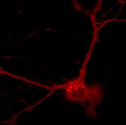 Shining a Fluorescent Light on the Brain