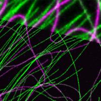 Tubulin Strands
