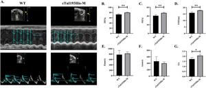 Cardiac function of 4-month-old mice.