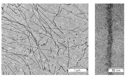 Electron micrograph of Sup35NM fibrils