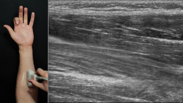 Future Smartwatches Could Sense Hand Movement Using Ultrasound Imaging
