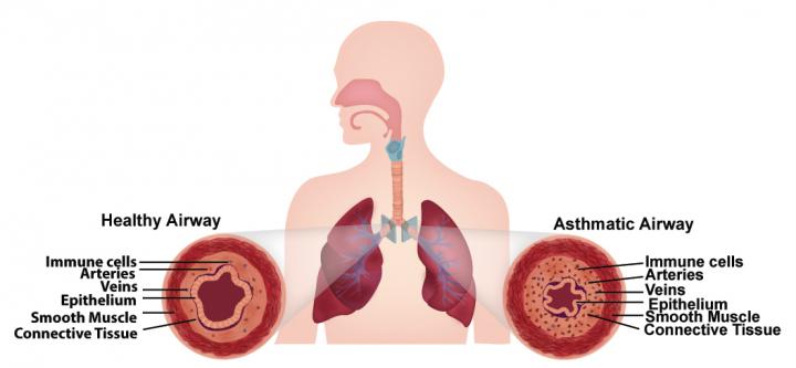 Airway Schematic